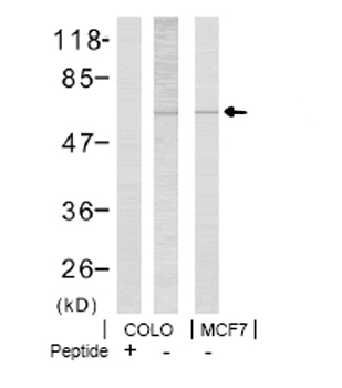 All lanes : Anti-LIM Kinase 1 (phospho T508) antibody (ab38508) at 1/500 dilutionLane 1 : Extract of COLO cells + peptide.Lane 2 : Extract of COLO cells.Lane 3 : Extract of MCF7 cells.Lysates/proteins at 30 µg per lane.SecondaryAlkaline Phosphatase AffiniPure Goat Anti-Rabbit IgG (H+L)