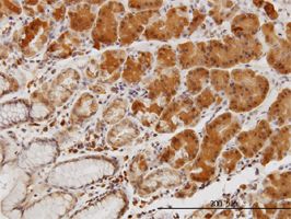 LIM Kinase 1 antibody (ab55414) used in immunohistochemistry at 3ug/ml on formalin fixed and paraffin embedded human stomach.