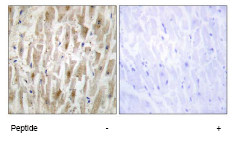 ab70116 at 1/50 dilution staining LIM kinase 2 in human heart by Immunohistochemistry, Paraffin-embedded tissue, in the absence or presence of the immunising peptide.