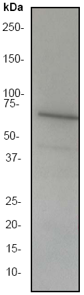 Anti-LIM kinase 2 antibody [EP969Y] (ab45165) at 1/2000 dilution + Ramos membrane