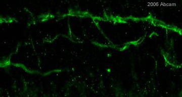ab14554 at 1/200 dilution staining mouse postnatal day 5 retina cells (known to express LIM 1) by ICC/IF. The cells were formaldehyde fixed and incubated with the antibody for 72 hours. An Alex-Fluor 488 conjugated donkey anti-rabbit antibody was used as the secondary. The image shows strong horizontal cell process labeling with fainter nuclear label.See Abreview
