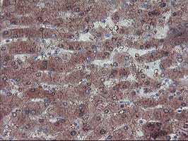 Immunohistochemical analysis of paraffin-embedded Human liver tissue labelling LIM1 with ab131642 at 1/150 dilution.