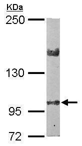 Anti-LIMCH1 antibody (ab96178) at 1/2000 dilution + Mouse brain whole cell lysate at 50 µg