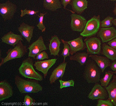 ICC/IF image of ab96178 stained A549 cells. The cells were 4% formaldehyde fixed (10 min) and then incubated in 1%BSA / 10% normal goat serum / 0.3M glycine in 0.1% PBS-Tween for 1h to permeabilise the cells and block non-specific protein-protein interactions. The cells were then incubated with the antibody (ab96178, 1µg/ml) overnight at +4°C. The secondary antibody (green) was ab96899, DyLight® 488 goat anti-rabbit IgG (H+L) used at a 1/250 dilution for 1h. Alexa Fluor® 594 WGA was used to label plasma membranes (red) at a 1/200 dilution for 1h. DAPI was used to stain the cell nuclei (blue) at a concentration of 1.43µM.
