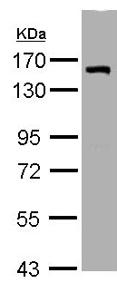 Anti-LIMCH1 antibody (ab96178) at 1/1000 dilution + H1299 whole cell lysate at 30 µg