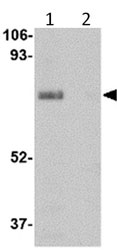 All lanes : Anti-LIMPII antibody (ab104653) at 1 µg/mlLane 1 : Human skeletal muscle tissue lysate with Absense of blocking peptideLane 2 : Human skeletal muscle tissue lysate with Presence of blocking peptide
