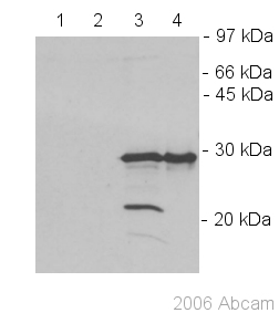 All lanes : Anti-Lin28 antibody (ab46020) at 1/1000 dilutionLane 1 : PC-3 cell extract in lysis buffer containing NP-40 at 45 µgLane 2 : PC-3 cell extract (Trizol bottom phase) at 30 µgLane 3 : Tera-2 cell extract (Trizol bottom phase) at 30 µgLane 4 : Tera-2 cell extract in lysis buffer containing NP-40 at 45 µgSecondaryGoat anti-rabbit HRP conjugated at 1/4000 dilution