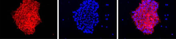 Immunofluorescent analysis of HEL 11.4 induced IPS cells labeling Lin28 with ab175352 at 1/200 and incubated with a fluorescently-conjugated secondary antibody. Nuclei (blue) were stained with DAPI.