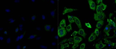 Immunofluorescent analysis of formalin-fixed and permeabilized HeLa cells (left image) and Human embryonal carcinoma NTERA-2 cells (right image) labeling Lin28 with ab175352 at 1/200 and and incubated with DyLight 488 goat-anti-rabbit IgG secondary antibody. Nuclei (blue) were stained with Hoechst 33342 dye.
