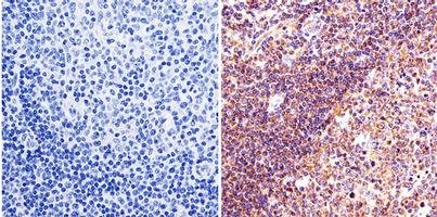 Immunohistochemical analysis of paraffin embedded Human tonsil tissue labeling Lin28 with ab175352 at 1/50.