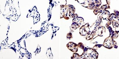 Immunohistochemical analysis of paraffin embedded Human placenta tissue labeling Lin28 with ab175352 at 1/50.
