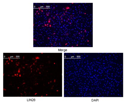 Immunofluorescence staining of methanol fixed HeLa cells were transfected with pMX construct of human Lin28. Cells were analyzed ~62 hours after transfection.