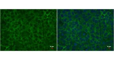 Immunofluorescence analysis of paraformaldehyde-fixed Human embryonic stem cells, labeling Lin28 using ab184213 at a 1/500 dilution (green, left panel). The image in the right panel was costained with Hoechst 33342 (blue).