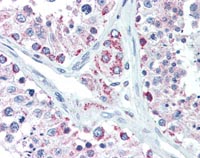 Immunohistochemistry Image of Human Testis (formalin-fixed, paraffin-embedded) stained with Lin28B antibody (ab115698) at 10 µg/ml followed by biotinylated goat anti-rabbit IgG secondary antibody, alkaline phosphatase-streptavidin and chromogen.