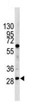 Anti-Lin28B antibody (ab115698) at 1/1000 dilution + HL60 cell line lysate at 35 µgSecondaryHRP goat anti-rabbit (H+L) at 1/5000 dilution