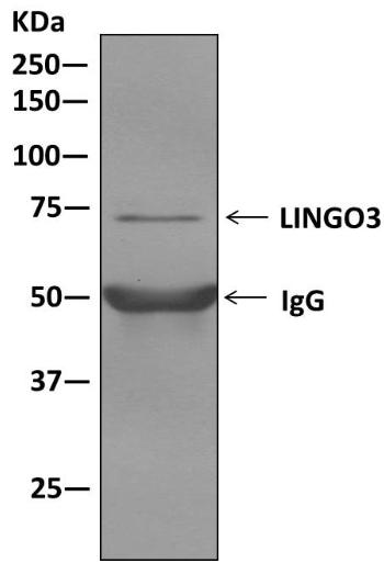 Western blot analysis on immunoprecipitation pellet from SH-SY5Y cell lysate using ab169772.