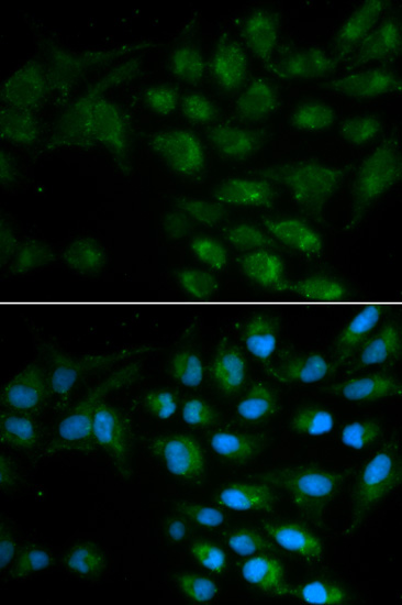 Immunocytochemistry/Immunofluorescence analysis of MCF7 cells using ab175105. Blue DAPI for nuclear staining.