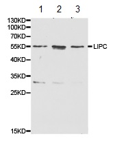 All lanes : Anti-LIPC antibody (ab175105) at 1/500 dilutionLane 1 : HepG2 cell extractsLane 2 : HT29 cell extractsLane 3 : MCF7 cell extracts