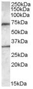 Anti-LIPG antibody (ab77543) at 0.3 µg/ml + Human liver lysate at 35 µg