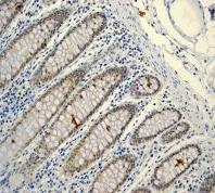 ab92316 at a 1/50 dilution, staining Lipin 1 in paraffin-embedded Human colon tissue.