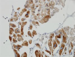 Lipoamide Dehydrogenase antibody (ab54641) used in immunohistochemistry at 3ug/ml on formalin fixed and paraffin embedded human heart.
