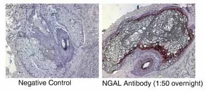 ab23477 staining human skin tissue sections by IHC-P.  Sections were fixed in 10% neutral buffered formalin and subjected to heat mediated antigen retrieval prior to blocking with 1% BSA for 1 hour at 25°C.  The primary antibody was diluted 1/50 and incubated with the sample for 20 hours at 4°C.  A biotinylated horse anti-mouse antibody diluted 1/200 was used as the secondary.See Abreview