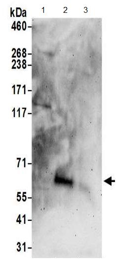 All lanes : Anti-Lipolysis Stimulated Lipoprotein Receptor antibody (ab191180) at 0.1 µg/mlLane 1 : HeLa whole cell lysate prepared using RIPA lysis buffer.Lane 2 : 293T whole cell lysate prepared using RIPA lysis buffer.Lane 3 : Jurkat whole cell lysate prepared using RIPA lysis buffer.Lysates/proteins at 50 µg per lane.developed using the ECL technique