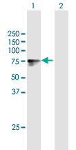 All lanes : Anti-Lipolysis Stimulated Lipoprotein Receptor antibody (ab169583) at 1 µg/mlLane 1 : Lipolysis Stimulated Lipoprotein Receptor-transfected 293T cell lysateLane 2 : Non-transfected 293T cell lysateLysates/proteins at 15 µl per lane.SecondaryGoat Anti-Mouse IgG (H&L)-HRP at 1/2500 dilutiondeveloped using the ECL technique