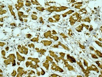 Immunohistochemical analysis of paraffin-embedded Human pancreas tissue labeling Lipoprotein lipase with ab172953 at a 1/250 dilution.