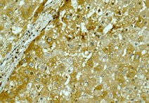 Immunohistochemical analysis of paraffin-embedded Human liver tissue labeling Lipoprotein lipase with ab172953 at a 1/250 dilution.