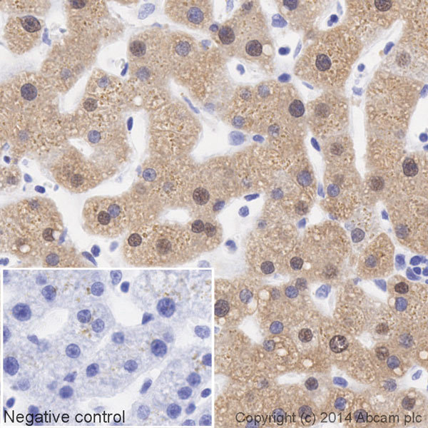 IHC image of Liver Arginase staining in a section of formalin-fixed paraffin-embedded normal human liver tissue*, performed on a Leica BOND. The section was pre-treated using heat mediated antigen retrieval with sodium citrate buffer (pH6, epitope retrieval solution 1) for 20mins. The section was then incubated with ab195510 at 1/500 dilution, for 15 mins at room temperature. DAB was used as the chromogen. The section was then counterstained with haematoxylin and mounted with DPX. The inset negative control image is taken from an identical assay without primary antibody.For other IHC staining systems (automated and non-automated) customers should optimize variable parameters such as antigen retrieval conditions, primary antibody concentration and antibody incubation times.*Tissue obtained from the Human Research Tissue Bank, supported by the NIHR Cambridge Biomedical Research Centre