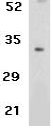 Anti-Livin antibody (ab5393) at 4 µg/ml + Human Raji cell lysateObserved band size : 33 kDa (why is the actual band size different from the predicted?)