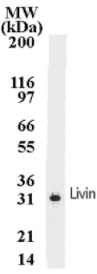 Livin detection by Western blot. The detection of Livin in cell extract transfected with human Livin cDNA. A protein of 31 kDa was detected by using anti-Livin at a 2 µg/ml dilution.