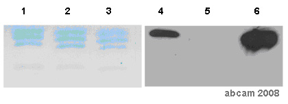 ab59563 was used to immunoprecipitate histone H3 di methyl K4 from mono-nucleosomes isolated from mature chicken oviduct. Lanes 1 - 3 Coomassie stain Lanes 4 - 6 ab8580 staining to demonstrate IP specificity Lanes 1 & 4 - Input Lanes 2 & 5 - Unbound Lanes 3 & 6 - Bound