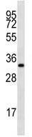 Anti-LIX1L antibody (ab112952) at 1/100 dilution + MDA-MB231 cell line lysate at 35 µg