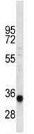 Anti-LIX1L antibody (ab112952) at 1/100 dilution + Mouse heart tissue lysate at 35 µg