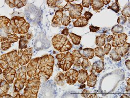 LLGL2 antibody (ab55423) used in immunohistochemistry at 1ug/ml on formalin fixed and paraffin embedded human salivary gland.