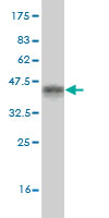 Western blot against tagged recombinant protein immunogen using ab55423 LLGL2 antibody at 1ug/ml. 