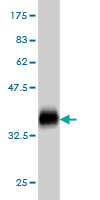 Western blot against tagged recombinant protein immunogen using ab56402 LMBR1 antibody at 1ug/ml.