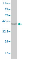 Western blot against tagged recombinant protein immunogen using ab56394 LMO4 antibody at 1ug/ml.