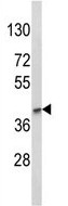 Anti-LMX1b antibody (ab135734) at 1/100 dilution + mouse heart tissue lysates at 35 µg