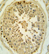 Immunohistochemical analysis of formalin-fixed, paraffin-embedded Human testis tissue labelling LMX1b with ab135734 at 1/50 dilution, followed by peroxidase-conjugated secondary antibody and DAB staining