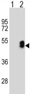 All lanes : Anti-LMX1b antibody (ab135734) at 1/100 dilutionLane 1 : 293 cell lysates, non-transfected Lane 2 : 293 cell lysates, transiently transfected with the LMX1B geneLysates/proteins at 2 µg per lane.