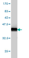 Western blot against tagged recombinant protein immunogen using ab56552 LNX2 antibody at 1ug/ml.