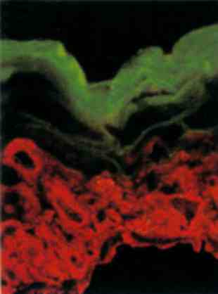Double-label immunofluorescence analysis of developing mouse epidermis showing E18 epidermis reacted with Texas Red -labled antibody to K14, which stains the periderm, and fluorescein isothiocyanate-labeled antibody to Loricrin (ab24722), which stains the upper layers of the epidermis, but not the periderm. Photo courtesy of DR Roop, Baylor College of Medicine. Reproduced from JR Bickenbach, JM Greer, DS Bundman, JA Rothangel, DR Roop. Loricrin expression is coordinated with other epidermal proteins and the appearance of lipid lamellar granules in development. J Invest Derm 10(3):405-410, 1995. Reprinted by permission of Blackwell Science Inc.