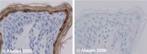Human normal foreskin. Staining is observed in cytoplasm and nucleoplasm. Left panel: with primary antibody at 1 ug/ml. Right panel:isotype control. Sections were stained using an automated system, at room temperature: sections were rehydrated and antigen retrieved with  buffers citrate pH6.1. Slides were peroxidase blocked in 3% H2O2 in methanol for 10 mins. They were then blocked with  for 10 minutes (containing casein 0.25% in PBS) then incubated with primary antibody for 20 min and detected with an amplification kit for rabbit for 30 minutes. Colorimetric detection was completed with Diaminobenzidine for 5 minutes. Slides were counterstained with Haematoxylin. Please note that for manual staining we recommend to optimize the primary antibody concentration and incubation time (overnight incubation), and amplification may be required.