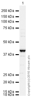 Anti-Loricrin antibody (ab85679) at 1 µg/ml + T47D (Human ductal breast epithelial tumor cell line) Whole Cell Lysate (ab14899) at 10 µgSecondaryGoat polyclonal to Rabbit IgG - H&L - Pre-Adsorbed (HRP) at 1/3000 dilutiondeveloped using the ECL techniquePerformed under reducing conditions.