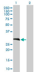 All lanes : Anti-Loricrin antibody (ab168310) at 1 µg/mlLane 1 : Loricrin transfected 293T cell lysateLane 2 : Non-transfected 293T cell lysate Lysates/proteins at 15 µl per lane.SecondaryGoat Anti-Mouse IgG (H&L)-HRP at 1/2500 dilutiondeveloped using the ECL technique