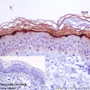 Immunohistochemical analysis of paraffin-embedded human skin tissue sections labeling Loricrin with ab198994 at a 1/500 dilution. Goat anti-rabbit IgG H&L (HRP) ab97051 used as the secondary at a 1/500 dilution. Counterstain hematoxylin.
