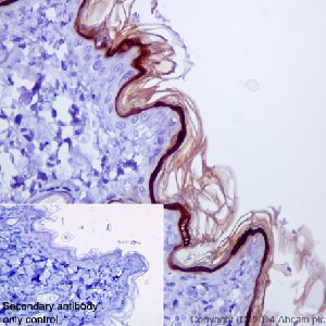 Immunohistochemical analysis of paraffin-embedded rat skin tissue sections labeling Loricrin with ab198994 at a 1/500 dilution. Goat anti-rabbit IgG H&L (HRP) ab97051 used as the secondary at a 1/500 dilution. Counterstain hematoxylin.
